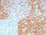 CD5 Antibody for IHC. Immunohistochemistry analysis of CD5 antibody staining in FFPE human tonsil tissue using an adaptive immune response marker antibody, clone C5/8117R. Strong membranous staining is observed in interfollicular T lymphocytes with dense labeling of T cell zones surrounding germinal centers, while follicular B cell regions remain largely negative. The staining pattern highlights normal tonsillar architecture and reflects the role of CD5 in antigen-driven adaptive immune responses within lymphoid tissue. Inset: PBS used in place of primary antibody shows no specific staining, confirming secondary antibody specificity. Heat-induced epitope retrieval was performed using pH 9 Tris-EDTA buffer for 20 minutes followed by cooling prior to antibody incubation.