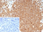 Immunohistochemistry analysis of Recombinant CD20 Antibody in human tonsil tissue. FFPE human tonsil demonstrates strong membranous HRP-DAB brown staining in B lymphocytes within germinal centers and follicular regions, consistent with CD20/MS4A1 expression on mature B cells, while surrounding non-B-cell areas show minimal staining. The inset image shows the PBS negative control with no specific signal. Antigen retrieval was performed by boiling tissue sections in pH 9 10mM Tris with 1mM EDTA for 20 minutes followed by cooling prior to incubation with recombinant CD20 antibody (clone MS4A1/8072R).