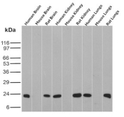 Ferritin Heavy Chain Antibody Multi-Species WB. Western blot analysis of human, mouse, and rat brain, kidney, and lung tissue lysates using recombinant monoclonal clone FTH/8700R demonstrates distinct bands near 20-24 kDa corresponding to Ferritin heavy chain / FTH1 across multiple organs and species. The broad tissue distribution supports the conserved role of FTH1 in intracellular iron storage, ferroxidase activity, and protection against oxidative stress-associated cellular injury in metabolically active tissues.