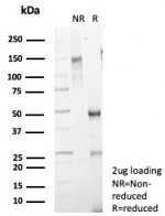 SDS-PAGE analysis of purified, BSA-free recombinant Mammaglobin antibody MGB/7980R as confirmation of integrity and purity.