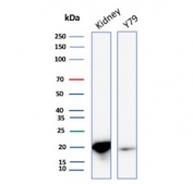Western blot testing of human kidney and Y79 cell lysate with Crystallin Alpha B antibody (clone CRYAB/4661). Predicted molecular weight ~20 kDa.