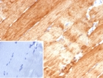 CRYAB Antibody Skeletal Muscle IHC. Immunohistochemistry of Alpha B crystallin / CRYAB in FFPE human skeletal muscle tissue using mouse monoclonal CRYAB antibody, clone CRYAB/4657. HRP-DAB brown staining highlights strong cytoplasmic labeling of myofibers with a striated pattern, consistent with the role of CRYAB as a stress-responsive chaperone protein in muscle cells, while surrounding connective tissue shows minimal staining and nuclei are counterstained blue. Inset: PBS was used in place of primary antibody as a negative control to confirm specificity of staining. Heat induced epitope retrieval was performed by boiling tissue sections in pH 9 10 mM Tris with 1 mM EDTA for 20 min followed by cooling prior to staining.