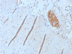CD56 Antibody Recombinant Rabbit MAb NCAM1/8392R. Immunohistochemistry of FFPE human colon tissue demonstrates membranous and cytoplasmic staining in scattered neural and neuroendocrine-associated cell clusters consistent with expression of Neural cell adhesion molecule 1 (NCAM1), also known as CD56. Brown chromogenic signal highlights CD56-positive cells within localized structures embedded in the surrounding stromal tissue, while most epithelial and stromal cells show minimal staining. Heat-induced epitope retrieval was performed by boiling tissue sections in pH 9 10mM Tris with 1mM EDTA for 20 minutes followed by cooling prior to antibody incubation.