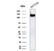 CD56 Antibody Recombinant Rabbit MAb NCAM1/8392R. Western blot analysis of human HCT-116 cell lysate demonstrates a strong band cluster between approximately 120-180 kDa corresponding to Neural cell adhesion molecule 1 (NCAM1), also known as CD56. These bands are consistent with the major transmembrane NCAM isoforms commonly detected in mammalian cells. Additional signal near approximately 110 kDa may represent a soluble or processed NCAM fragment. The band pattern reflects the presence of multiple NCAM1 isoforms and the heavily glycosylated nature of this cell adhesion molecule.