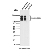 NCAM Antibody for WB (clone NCAM1/9074R). Western blot analysis of human brain, mouse brain, and rat brain tissue lysates demonstrates multiple bands between approximately 120-180 kDa, consistent with known isoforms of Neural cell adhesion molecule 1 (NCAM1), also known as CD56. These bands correspond to the major NCAM protein variants produced by alternative splicing and post-translational modification. Detection of NCAM1 across human, mouse, and rat brain samples reflects the strong expression of this adhesion molecule in neural tissues and supports its established role in neuronal development and cell-cell adhesion.