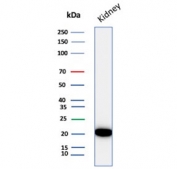 CRYAB Antibody Renal Tissue WB. Western blot analysis of Alpha B crystallin / CRYAB in human kidney tissue lysate using mouse monoclonal CRYAB antibody, clone CRYAB/4659. A band is detected at approximately 20 kDa, consistent with the predicted molecular weight of CRYAB, supporting detection of this small heat shock protein in renal tissue under physiological conditions.