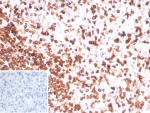 CD3e Antibody. Immunohistochemistry analysis of CD3 Epsilon / CD3E antibody in FFPE human spleen tissue using CD3e Antibody / Pan T Cell Lineage Marker Antibody with Clone rC3e/8881. Strong HRP-DAB brown membranous and cytoplasmic staining is observed in T lymphocytes distributed throughout the white pulp and periarteriolar lymphoid sheath regions, consistent with T-cell lineage localization, while surrounding non-lymphoid cells show minimal background. The inset shows the negative control with PBS used in place of the primary antibody, demonstrating absence of non-specific staining. Heat-induced epitope retrieval was performed by boiling tissue sections in pH 9 10 mM Tris with 1 mM EDTA for 20 minutes followed by cooling prior to antibody incubation.