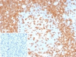 CD3 epsilon Antibody Recombinant Rabbit Monoclonal. Immunohistochemistry analysis of CD3 Epsilon / CD3E antibody in FFPE human tonsil tissue using CD3 epsilon Antibody Recombinant Rabbit Monoclonal Clone C3e/8115R. Strong HRP-DAB brown membranous and cytoplasmic staining is observed in T lymphocytes within interfollicular and paracortical regions, consistent with T-cell zone distribution, while surrounding non-lymphoid cells show minimal background. The inset shows the negative control with PBS used in place of the primary antibody, demonstrating absence of non-specific staining. Heat-induced epitope retrieval was performed by boiling tissue sections in pH 9 10 mM Tris with 1 mM EDTA for 20 minutes followed by cooling prior to antibody incubation.