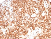 CD3G Antibody Human Lymph Node IHC. Immunohistochemical staining of FFPE human lymph node tissue with CD3G / CD3beta1 antibody (clone CD3G/8794). Heat-induced epitope retrieval (HIER) was performed by boiling tissue sections in pH 9, 10 mM Tris with 1 mM EDTA for 20 minutes and allowing them to cool prior to staining. CD3G immunoreactivity is observed predominantly along the cell membranes and within the cytoplasm of lymphocytes, consistent with the expected localization of this T-cell receptor complex protein involved in antigen recognition and T-cell activation. Cell nuclei are counterstained with hematoxylin (blue).