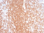 CD27 Antibody for LN IHC. Immunohistochemistry analysis of CD27 / TNFRSF7 expression in FFPE human lymph node tissue using CD27 Antibody / Tumor Immune Microenvironment Marker Antibody clone LPFS2/8574R. Strong membranous HRP-DAB brown staining is observed in dense lymphocyte populations within nodal cortical and paracortical regions, consistent with CD27 expression on activated and antigen-experienced T and B cells, while non-lymphoid stromal elements remain largely negative. The staining pattern highlights immune cell distribution and supports evaluation of lymphocyte-rich microenvironments relevant to tumor-associated immune infiltration. Heat-induced epitope retrieval was performed in pH 9 10 mM Tris with 1 mM EDTA for 20 minutes followed by cooling prior to antibody incubation.