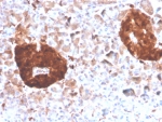 Gamma Enolase Antibody Pancreas IHC. Immunohistochemistry staining of FFPE human pancreas tissue with Gamma Enolase antibody (clone ENO2/4507). HIER: boil tissue sections in pH 9 10mM Tris with 1mM EDTA for 20 min and allow to cool before testing.