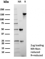 SDS-PAGE analysis of purified, BSA-free NSE gamma antibody (clone ENO2/7447) as confirmation of integrity and purity.