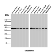 NSE Gamma Antibody Multi-Species Brain and Heart WB. Western blot analysis of brain and heart tissue lysates from human, mouse, rat, hamster, guinea pig, and rabbit using NSE Gamma Antibody (clone ENO/8632R) detects a band at the predicted molecular weight of approximately 47 kDa, consistent with gamma enolase (ENO2) expression across multiple species, supporting conserved detection in both neural and non-neural tissues.