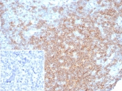 CD27 Antibody for Human Lymph Node Tissue IHC. Immunohistochemistry analysis of CD27 / TNFRSF7 expression in FFPE human lymph node tissue using CD27 Antibody / Lymphocyte Differentiation Marker Antibody clone LPFS2/8316R. Membranous HRP-DAB brown staining is observed in lymphocyte populations within follicular and paracortical regions, consistent with CD27 expression on antigen-experienced and differentiated T and B cells, while surrounding stromal elements remain largely negative. The staining pattern highlights lymphocyte maturation compartments and supports evaluation of differentiation states within lymphoid tissue architecture. Inset: PBS used in place of primary Ab (secondary Ab negative control). Heat-induced epitope retrieval was performed in pH 9 10 mM Tris with 1 mM EDTA for 20 minutes followed by cooling prior to antibody incubation.
