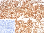 CD27 Antibody for IHC. Immunohistochemistry analysis of CD27 / TNFRSF7 expression in FFPE human tonsil tissue using CD27 Antibody / Immune Memory Formation Marker Antibody clone LPFS2/8607R. Strong membranous HRP-DAB brown staining is observed in lymphocyte populations within germinal centers and interfollicular regions, consistent with CD27 expression on memory T cells and memory B cells, while surrounding stromal elements remain largely negative. The staining pattern highlights immune memory compartments and supports evaluation of antigen-experienced lymphocyte populations within tonsillar tissue. Inset: PBS used in place of primary Ab (secondary Ab negative control). Heat-induced epitope retrieval was performed in pH 9 10 mM Tris with 1 mM EDTA for 20 minutes followed by cooling prior to antibody incubation.
