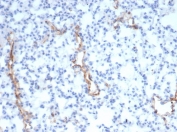 von Willebrand Factor Antibody / Platelet Adhesion Mediator Antibody. Immunohistochemistry analysis of mouse lung tissue shows HRP-DAB brown staining of endothelial cells lining vascular structures, including small vessels and capillary networks within the pulmonary parenchyma. The staining highlights vessel-associated endothelial surfaces where VWF is present, consistent with its role in mediating platelet adhesion along the vascular lining. Elongated and branching vascular profiles are clearly delineated from surrounding alveolar and interstitial cells. Clone VWF/4105 enables visualization of vascular endothelium in a pattern aligned with adhesive hemostatic function at the vessel interface. HIER: boil tissue sections in pH 9 10mM Tris with 1mM EDTA for 20 min and allow to cool before testing.