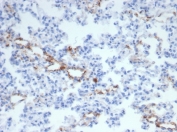 von Willebrand Factor Antibody / Platelet Adhesion Mediator Antibody. Immunohistochemistry analysis of rat lung tissue shows HRP-DAB brown staining of endothelial cells lining pulmonary vascular channels and capillary networks within the alveolar parenchyma. The staining highlights vessel-associated endothelial surfaces where VWF is localized, consistent with its role in platelet tethering and adhesion along the vascular lining. Thin, branching capillary structures are clearly delineated from surrounding alveolar cells and interstitial tissue. Clone VWF/4105 enables visualization of vascular endothelium in a pattern aligned with adhesive hemostatic function at the vessel interface. HIER: boil tissue sections in pH 9 10mM Tris with 1mM EDTA for 20 min and allow to cool before testing.