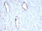 IHC staining of FFPE human uterus tissue with vWF/von Willebrand Factor antibody (clone VWF/4105). HIER: boil tissue sections in pH 9 10mM Tris with 1mM EDTA for 20 min and allow to cool before testing.