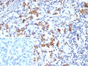 CD163L1 Antibody Lymph Node IHC. Immunohistochemistry staining of FFPE human lymph node tissue using CD163L1 Antibody demonstrates distinct membranous and cytoplasmic HRP-DAB brown staining in scattered macrophage-like cells within the lymphoid microenvironment. The staining pattern is consistent with expression of CD163 Like 1 / CD163L1, a scavenger receptor family protein associated with monocyte-macrophage lineage populations and innate immune regulation. Clone CD163L1/7974 highlights immune cells involved in antigen processing, tissue surveillance, and maintenance of lymphoid tissue homeostasis. Inset: PBS was used in place of the primary antibody as a secondary antibody negative control. HIER: boil tissue sections in pH 9 10mM Tris with 1mM EDTA for 20 min and allow to cool before testing.