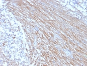 CD303 Antibody Placental Tissue IHC. Immunohistochemistry analysis of FFPE human placental tissue using CD303 Antibody (clone CLEC4C/3400) shows membranous and cytoplasmic staining in scattered immune cells within the tissue, consistent with CD303 / CLEC4C (BDCA2) expression on plasmacytoid dendritic cells. Positive cells are distributed within stromal regions, while surrounding structural elements display minimal background staining. Hematoxylin counterstain provides nuclear contrast and tissue architecture. HIER: boil FFPE tissue sections in pH 9 10 mM Tris with 1 mM EDTA for 20 min and allow to cool before testing.