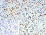 CD163L1 Antibody Human Lymph Node IHC. Immunohistochemistry staining of FFPE human lymph node tissue using CD163L1 antibody demonstrates distinct cytoplasmic and membranous HRP-DAB brown staining in scattered macrophage-like cells distributed throughout the lymphoid tissue. The staining pattern is consistent with expression of CD163 Like 1 / CD163L1, a scavenger receptor family protein associated with monocyte-macrophage lineage populations and innate immune regulation. Clone CD163L1/7971 highlights immune cells involved in tissue surveillance, antigen handling, and maintenance of lymphoid microenvironment homeostasis. Inset: PBS was used in place of the primary antibody as a secondary antibody negative control. HIER: boil tissue sections in pH 9 10mM Tris with 1mM EDTA for 20 min and allow to cool before testing.