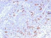 CD163L1 Antibody Human Tonsil IHC. Immunohistochemistry staining of FFPE human tonsil tissue using CD163L1 antibody demonstrates distinct cytoplasmic and membranous HRP-DAB brown staining in scattered macrophage-like cells distributed throughout the lymphoid tissue. The staining pattern is consistent with expression of CD163 Like 1 / CD163L1, a scavenger receptor family protein associated with monocyte-macrophage lineage populations and innate immune regulation. Clone CD163L1/7971 highlights tissue-resident myeloid cells involved in immune surveillance, antigen processing, and maintenance of the tonsillar immune microenvironment. HIER: boil tissue sections in pH 9 10mM Tris with 1mM EDTA for 20 min and allow to cool before testing.