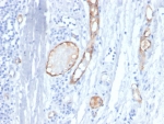 von Willebrand Factor Antibody / Vascular Integrity Marker Antibody. Immunohistochemistry analysis of human tonsil tissue shows HRP-DAB brown staining of endothelial cells forming continuous vascular linings within lymphoid tissue. The staining outlines well-defined vessel boundaries with smooth, intact endothelial contours, highlighting preserved vascular architecture. Endothelial-lined channels are clearly distinguished from surrounding lymphoid cells, allowing assessment of vessel continuity and structural organization within the tissue. Clone VWF/4458 enables visualization of vascular integrity and endothelial preservation across the sampled region. HIER: boil tissue sections in pH 9 10mM Tris with 1mM EDTA for 20 min and allow to cool before testing.