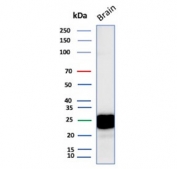 Western blot testing of human brain tissue lysate with CD9 antibody. Predicted molecular weight: 23-27 kDa.