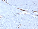 von Willebrand Factor Antibody / Tumor Vasculature Marker Antibody. Immunohistochemistry analysis of human uterus tissue shows HRP-DAB brown staining of endothelial cells lining vascular channels within stromal regions, forming elongated and irregular vessel structures embedded in the tissue microenvironment. The staining pattern emphasizes tumor-associated vascular architecture, with clearly defined endothelial linings outlining small vessels and branching channels distinct from surrounding stromal and smooth muscle cells. Clone VWF/7979R enables visualization of vascular distribution and vessel morphology within uterine tissue. HIER: boil tissue sections in pH 9 10mM Tris with 1mM EDTA for 20 min and allow to cool before testing.