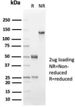 SDS-PAGE analysis of purified, BSA-free Keratin 18 antibody (clone KRT18/7056R) as confirmation of integrity and purity.