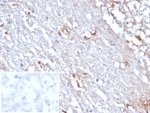 Immunohistochemistry analysis of STAT6 antibody in human cerebellum tissue (clone STAT6/7774R). FFPE human cerebellum sections demonstrate HRP-DAB brown staining predominantly in the cytoplasm and nuclei of scattered cells within the cerebellar cortex and white matter regions. The staining pattern is consistent with Signal transducer and activator of transcription 6 localization, reflecting its cytoplasmic presence with potential nuclear translocation upon activation. Background neuropil shows minimal non-specific staining. The inset shows PBS used in place of primary antibody as a secondary antibody negative control, demonstrating absence of specific brown staining. Heat induced epitope retrieval was performed by boiling tissue sections in pH 9 10 mM Tris with 1 mM EDTA for 20 minutes followed by cooling prior to antibody incubation.