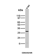CDK4 Antibody K-562 WB. Western blot analysis of Cyclin-dependent kinase 4 (CDK4) expression in K-562 cell lysate using CDK4 antibody clone CDK4/8210R. Lane 1: K-562 cell lysate. A band is detected at approximately 33-34 kDa, consistent with the predicted molecular weight of CDK4, a key regulator of G1 to S phase cell cycle progression. A faint lower-molecular-weight band is also observed below 20 kDa, which may represent proteolytic processing or non-specific reactivity.