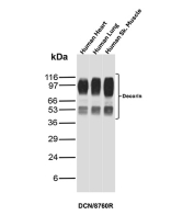 Decorin Antibody Human Tissue Panel WB. Western blot analysis of human 1) heart, 2) lung, and 3) skeletal muscle tissue lysates using Decorin Antibody (clone DCN/8760R) detects multiple bands between approximately 50-120 kDa, consistent with glycosylated and partially processed forms of Decorin (DCN). The higher molecular weight bands reflect glycosaminoglycan-modified Decorin, while lower bands likely represent core protein or proteolytic fragments. The consistent banding pattern across tissues supports reliable detection of DCN and its post-translationally modified variants in extracellular matrix-rich samples.
