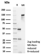 Periostin Antibody SDS-PAGE. SDS-PAGE analysis of purified Periostin antibody, clone POSTN/8951R, under reducing (R) and non-reducing (NR) conditions with 2 ug protein loading. The non-reduced sample shows a predominant band corresponding to intact immunoglobulin, while the reduced sample resolves into bands consistent with heavy and light chains, confirming antibody integrity and expected structural composition.
