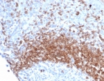 Recombinant IgD Antibody Rabbit Monoclonal IGHD/6818R immunohistochemistry analysis of human tonsil tissue. Formalin-fixed paraffin-embedded human tonsil tissue stained with Recombinant IgD Antibody Rabbit Monoclonal IGHD/6818R shows HRP-DAB brown chromogenic staining in B lymphocytes within lymphoid follicles. Positive cells are concentrated in mantle zone regions surrounding germinal centers and display membranous and cytoplasmic staining consistent with Immunoglobulin D expression in mature naive B lymphocytes. The inset shows the negative control in which PBS was used in place of the primary antibody, demonstrating absence of specific staining. Heat induced epitope retrieval was performed by boiling tissue sections in pH 9 10mM Tris with 1mM EDTA for 20 minutes followed by cooling prior to antibody incubation.