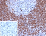 Recombinant IgD Antibody Rabbit Monoclonal IGHD/6818R immunohistochemistry analysis of human lymph node tissue. Formalin-fixed paraffin-embedded human lymph node tissue stained with Recombinant IgD Antibody Rabbit Monoclonal IGHD/6818R shows HRP-DAB brown chromogenic staining in B lymphocytes within lymphoid follicles. Positive cells are predominantly localized to mantle zone regions surrounding germinal centers and display membranous and cytoplasmic staining consistent with Immunoglobulin D expression in mature naive B lymphocytes. The inset shows the negative control in which PBS was used in place of the primary antibody, demonstrating absence of specific staining. Heat induced epitope retrieval was performed by boiling tissue sections in pH 9 10mM Tris with 1mM EDTA for 20 minutes followed by cooling prior to antibody incubation.