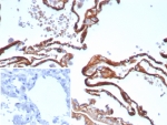 Immunohistochemistry of Periostin antibody in human lung tissue. Formalin-fixed, paraffin-embedded human lung was stained with recombinant monoclonal Periostin antibody (clone POSTN/8523R) following heat-induced epitope retrieval by boiling in pH 9 10 mM Tris with 1 mM EDTA for 20 minutes and cooling prior to testing. HRP-DAB brown chromogenic signal highlights extracellular matrix and stromal regions along alveolar septa and peribronchial connective tissue, consistent with the secreted and matrix-associated localization of Periostin. The inset image shows PBS in place of the primary antibody as a secondary-only negative control, demonstrating minimal non-specific background staining.