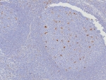 CD107a Antibody Human Tonsil IHC. Immunohistochemical staining of FFPE human tonsil tissue using CD107a antibody (clone LAMP1/7457) following heat-induced epitope retrieval in pH9 Tris-EDTA buffer. Staining was visualized using an HRP secondary antibody with DAB chromogen. Distinct membranous and cytoplasmic staining is observed in scattered immune cells within the tonsil, consistent with the expression pattern of CD107a (Lysosomal Associated Membrane Protein 1) in activated lymphocytes and other immune cell populations. This result demonstrates that the CD107a antibody is suitable for detecting endogenous LAMP1 expression in FFPE human lymphoid tissue.