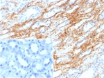 Immunohistochemistry of Collagen IV antibody in human kidney tissue. Formalin-fixed, paraffin-embedded human kidney was stained using recombinant rabbit monoclonal Collagen IV antibody (clone COL4/8657R). Heat induced epitope retrieval was performed by boiling tissue sections in 10mM Tris with 1mM EDTA, pH 9, for 20 min followed by cooling prior to staining. Strong HRP-DAB brown staining outlines glomerular basement membranes and tubular basement membranes, consistent with extracellular localization of Collagen type IV within renal tissue. The inset shows PBS used in place of primary antibody as a secondary-only negative control.