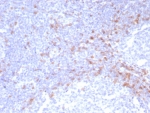 Recombinant IgD Heavy Chain Antibody IGHD/8228R immunohistochemistry analysis of human tonsil tissue. Formalin-fixed paraffin-embedded human tonsil tissue stained with Recombinant IgD Heavy Chain Antibody IGHD/8228R shows HRP-DAB brown chromogenic staining in B lymphocytes within lymphoid follicles. Positive cells are distributed primarily in mantle zone regions surrounding germinal centers and display membranous and cytoplasmic staining consistent with IgD expression in mature naive B cells. Heat induced epitope retrieval was performed by boiling tissue sections in pH 9 10mM Tris with 1mM EDTA for 20 minutes followed by cooling prior to antibody incubation.