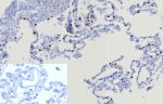 NKX2.1 Antibody for IHC / NKX2.1 Immunohistochemistry Antibody (clone TTF1/8123R) immunohistochemistry analysis of human lung tissue. Formalin-fixed, paraffin-embedded human lung tissue stained with recombinant rabbit monoclonal clone TTF1/8123R antibody demonstrates nuclear staining in pulmonary epithelial cells within alveolar structures, consistent with the nuclear localization of Thyroid transcription factor 1 (NKX2-1). The nuclear immunoreactivity highlights NKX2-1 expression in respiratory epithelial cells detected by immunohistochemistry in FFPE lung tissue sections. Inset: PBS used in place of primary antibody (secondary antibody negative control). HIER: boil tissue sections in pH 9 10mM Tris with 1mM EDTA for 20 min and allow to cool before testing.