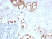 CKB Antibody Kidney IHC. Immunohistochemistry staining of FFPE human kidney tissue with recombinant CKB antibody (clone rCKBB/8839). Inset: PBS used in place of primary Ab (secondary Ab negative control). HIER: boil tissue sections in pH 9 10mM Tris with 1mM EDTA for 20 min and allow to cool before testing.