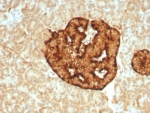 CGA Antibody Human Pancreas IHC. Immunohistochemistry of CGA Antibody Recombinant Rabbit MAb in human pancreas. Formalin-fixed, paraffin-embedded human pancreas tissue stained with CGA antibody (clone CHGA/8929R) shows strong cytoplasmic granular staining within islets of Langerhans, consistent with Chromogranin A expression in pancreatic neuroendocrine cells, while surrounding exocrine acinar tissue demonstrates minimal staining. Heat-induced epitope retrieval was performed by boiling sections in pH 9 10mM Tris with 1mM EDTA for 20 minutes followed by cooling prior to testing.