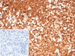 HSP90AA1 Antibody Spleen IHC. Immunohistochemistry staining of FFPE human spleen tissue using HSP90AA1 Antibody / Molecular Chaperone Antibody (clone HSP90AA1/7426) demonstrates strong diffuse cytoplasmic HRP-DAB brown staining throughout splenic lymphoid cell populations. The staining pattern is consistent with expression of HSP90AA1 (HSP90 alpha), a highly conserved ATP-dependent molecular chaperone that regulates protein folding, stabilization of client proteins, signal transduction, and maintenance of cellular homeostasis. HSP90AA1 is broadly expressed in immune cells where it supports proteostasis, stress-response pathways, and the functional activity of numerous signaling proteins. The inset image shows the negative control in which PBS was used in place of the primary antibody. HIER was performed by boiling tissue sections in pH 9, 10 mM Tris with 1 mM EDTA for 20 minutes followed by cooling prior to immunostaining.