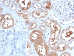 HSP90 alpha Antibody Kidney IHC. Immunohistochemistry staining of FFPE human kidney tissue using HSP90 alpha Antibody / HSP90AA1 (clone HSP90AA1/7247) demonstrates strong cytoplasmic HRP-DAB brown staining within renal tubular epithelial cells, with comparatively weaker staining in surrounding stromal and glomerular compartments. The staining pattern is consistent with expression of HSP90 alpha (HSP90AA1), a highly conserved ATP-dependent molecular chaperone involved in protein folding, stabilization of client proteins, signal transduction, and maintenance of cellular homeostasis. HSP90 alpha is abundantly expressed in metabolically active epithelial cells where it supports proteostasis and the function of numerous signaling proteins. The inset image shows the negative control in which PBS was used in place of the primary antibody. HIER was performed by boiling tissue sections in pH 9, 10 mM Tris with 1 mM EDTA for 20 minutes followed by cooling prior to immunostaining.