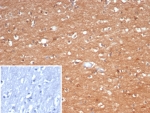 Creatine Kinase B Antibody Human Brain IHC. Immunohistochemistry analysis of FFPE human brain tissue using Creatine Kinase B antibody. The mouse monoclonal antibody clone CKBB/6566 shows widespread, diffuse cytoplasmic staining across neuronal populations, consistent with Creatine kinase B / CKB expression as a consistent expression marker. Signal is broadly distributed throughout neuronal cell bodies and processes, reflecting stable metabolic enzyme expression, while background staining remains minimal. A PBS-only control confirms low non-specific staining. HIER: boil tissue sections in 10 mM Tris with 1 mM EDTA, pH 9, for 20 min followed by cooling prior to staining.