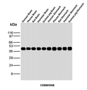 Brain Creatine Kinase Antibody Multi-Species WB. Western blot analysis of human brain, mouse brain, rat brain, hamster brain, guinea pig brain, human stomach, mouse stomach, rat stomach, hamster stomach, and guinea pig stomach tissue lysates using Brain Creatine Kinase antibody. The mouse monoclonal antibody clone CKBB/6568 detects a band at approximately 43 kDa, consistent with the predicted molecular weight of Creatine kinase B / CKB. Strong and consistent detection in brain samples aligns with the known neuronal energy homeostasis function of this cytosolic enzyme, while cross-species banding supports its conserved role in ATP buffering across diverse tissues.