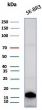 GCHFR Antibody SK-BR-3 WB. Western blot analysis of human SK-BR-3 cell lysate using GCHFR Antibody clone GCHFR/7734 demonstrates a distinct band at approximately 10-12 kDa, consistent with the predicted molecular weight of GTP cyclohydrolase I feedback regulator / GCHFR. The observed expression pattern aligns with the role of GCHFR as a tetrahydrobiopterin-associated metabolic regulatory protein involved in nitric oxide signaling, cofactor homeostasis, and intracellular redox-associated pathways.