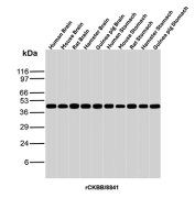 Creatine Kinase B Antibody for WB Multi-Species Tissue. Western blot analysis of Human Brain, Mouse Brain, Rat Brain, Hamster Brain, Guinea pig Brain, Human Stomach, Mouse Stomach, Rat Stomach, Hamster Stomach and Guinea pig Stomach tissue lysates using recombinant Creatine kinase B antibody (clone rCKBB/8841). Predicted molecular weight ~43 kDa.