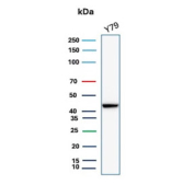 Creatine Kinase B Antibody for WB Human Y79 Cells. Western blot testing of human Y79 cell lysate with recombinant Creatine kinase B antibody. Predicted molecular weight ~43 kDa.